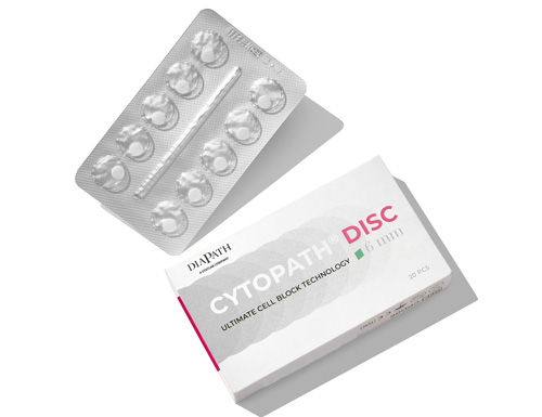 StatLab Introduces CytoPath Disc, Enhancing Global Standards in Cell Block Preparation
