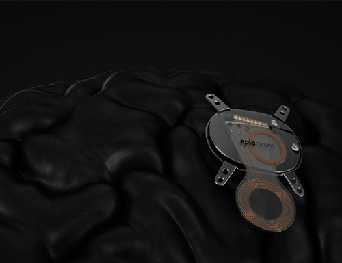 Epia Neuro Launches Intent-Driven Neural Technology to Restore Function After Stroke and Address Cognitive Decline