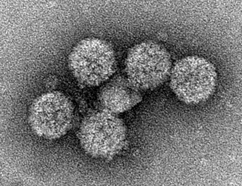 Orthogon Therapeutics Raises an Additional $11M Financing for Its BK Virus Antiviral Drug Program