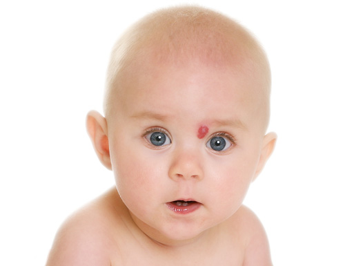 Arkayli Biopharma Inc. Receives FDA Study May Proceed Response to IND and NIH SBIR Grant to Advance Clinical Development of ARK001 for a Rare Pediatric Disease